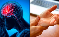 Dấu hiệu nguy hiểm nhất của đột quỵ không phải tê tay chân, nhiều người Việt hiểu lầm mà không biết