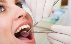 Những điều cần biết khi nhổ răng khôn
