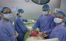 Phẫu thuật lấy khối u 6,5kg trong cơ thể người