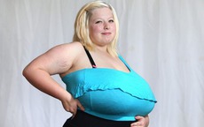 Cô gái trẻ có bộ ngực nặng gần 10 kg