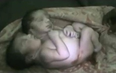 Cuộc sống ngắn ngủi của bé sơ sinh hai đầu Ấn Độ