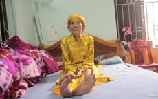 Kỳ lạ cụ ông 104 tuổi "bàn chân Giao Chỉ" cả đời không đi vừa đôi dép nào