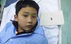 Bé trai 7 tuổi nuốt đầu bút bi, mắc kẹt trong phế quản