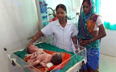 Bà mẹ Ấn Độ tuyệt vọng khi sinh cặp song sinh dính liền