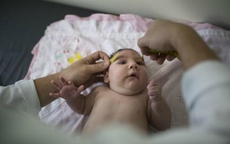 3 - 4 triệu trẻ sơ sinh có khả năng bị teo não do virus Zika từ muỗi