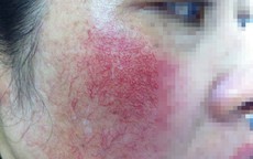 Những hóa chất độc hại chứa trong mỹ phẩm mà bạn không biết