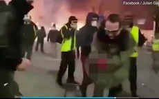 Người biểu tình Pháp bị nổ nát bàn tay vì cầm lựu đạn cay