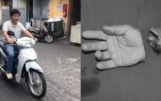 Lái xe máy vù vù sau 3 tháng bị đứt lìa bàn tay