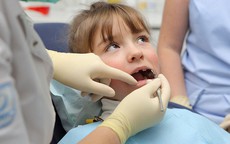 Khi nào cần điều trị trẻ nghiến răng?