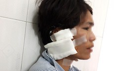 Thiếu phụ bị chồng cũ đâm dao vì không cho vay một triệu đồng