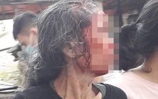 Phú Thọ: Con rể chém mẹ vợ trọng thương xong thản nhiên ngồi hút thuốc