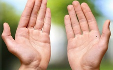 10 dấu hiệu trên đôi tay tố cáo tình trạng sức khỏe