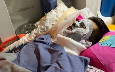 Việt kiều bị tạt axit, cắt gân chân: Thu giữ nhiều chứng cứ quan trọng