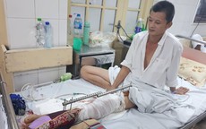 Vừa mất vợ vì tai nạn giao thông, người đàn ông bất hạnh lại có nguy cơ mất chân vì không tiền điều trị