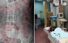 Bé gái 11 tuổi nhập viện cấp cứu vì đau dạ dày, bác sĩ chỉ đích danh thủ phạm là 1 sở thích tai hại của rất nhiều bé