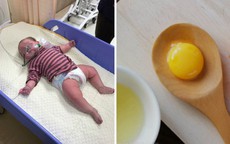 Bé 6,5 tháng ăn trứng xong suy hô hấp: BS cảnh báo dấu hiệu dị ứng mẹ cần biết để con không nguy hiểm