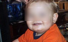 Bị mẹ cùng nhân tình đánh đập và lạm dụng, cậu bé qua đời vào đúng sinh nhật 1 tuổi với 86 vết thương
