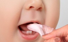 Thuốc gì trị tưa miệng ở trẻ sơ sinh?