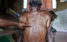 Số phận bi thảm của người bị kết tội phù thủy ở Papua New Guinea