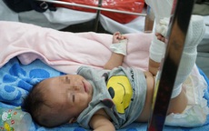 Thông tin mới nhất về sức khỏe của bé 4 tháng tuổi bị bố đánh gãy chân, xuất huyết não