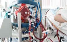 Bác gái bệnh nhân 17 trở nặng, chuyên gia hội chẩn liên tục, xem xét đặt lại ECMO