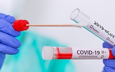 Người đầu tiên tái nhiễm Covid-19 sau hơn 4 tháng khỏi