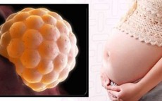 Từ vụ cô gái 20 tuổi bị chửa trứng: Những dấu hiệu đặc biệt quan trọng chị em cần lưu ý để phát hiện sớm tình trạng bất thường thai nghén này
