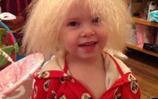 Cuộc sống của bé gái Anh có mái tóc giống thiên tài Vật lý Einstein