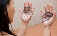 7 cách kiểm tra tình trạng tóc rụng