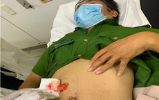 Chiến sĩ công an ở Thừa Thiên Huế bị đâm trọng thương khi đang làm nhiệm vụ 