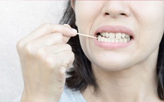 5 thói quen tàn phá răng lợi của bạn, không muốn hỏng răng sớm cần tránh ngay