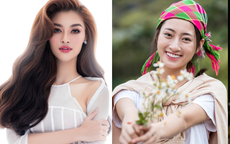 Miss World Việt Nam 2022 có thể phẫu thuật thẩm mỹ
