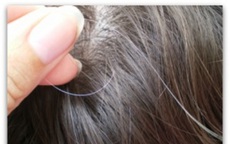Người trẻ tóc ngày càng bạc sớm hơn: 9 sự thật đập tan các lầm tưởng về tóc bạc