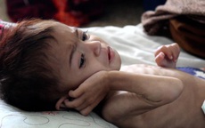 Em bé 3 tuổi nặng chỉ bằng một đứa trẻ sơ sinh: Những hình ảnh đau xót của Afghanistan về cơn bão đói nghèo đang trầm trọng hơn bao giờ hết