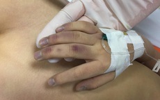 Vụ bé gái 6 tuổi ở Hà Nội tử vong: Bố đánh trong lúc kèm học gây sốc chấn thương, trào ngược thức ăn