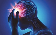 4 thói quen tai hại khiến tai biến mạch máu não ngày càng phổ biến ở người trẻ tuổi