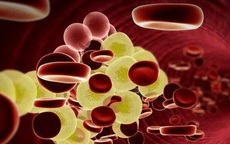Cảnh báo nguy hiểm do tăng lipid máu và giải pháp thảo dược giúp hạ mỡ máu hiệu quả!
