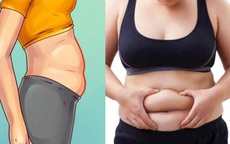 Có 3 kiểu béo bụng không phải do thừa cân, béo phì mà là ngầm cảnh báo một vài căn bệnh khác