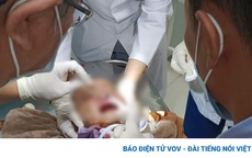 Xác minh thông tin cảnh sát giao thông làm em bé 3 tuổi bị trọng thương