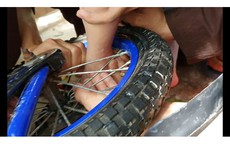 Phụ huynh bất cẩn, bé 2 tuổi dập nát gót chân vì kẹt vào nan xe đạp