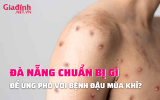 Đà Nẵng: Chuẩn bị sẵn sàng nhiều phương án để ứng phó với bệnh đậu mùa khỉ