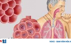 Vì sao người cao tuổi viêm phổi nhưng không có triệu chứng sốt?