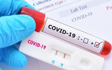 Cần biết: Giá dịch vụ xét nghiệm COVID-19 mới nhất áp dụng từ hôm nay