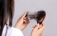 Bác sĩ tư vấn cách khắc phục rụng tóc hậu Covid-19