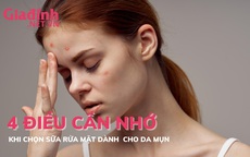 4 điều cần nhớ khi chọn sữa rửa mặt dành cho da mụn 