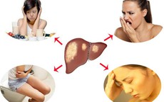 6 dấu hiệu cơ thể cảnh báo gan của bạn đang nhiễm độc, cần dừng ngay những thói quen này và thải độc cho gan