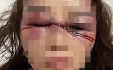 Thanh Hoá: Người phụ nữ bị hành hung dã man trong đêm
