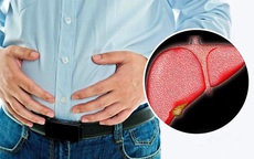 Cảnh báo: Ngoài béo phì, 7 lý do này cũng khiến gan bạn nhiễm mỡ
