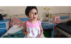 MS 884: Xót xa hoàn cảnh bé gái có khối u đẩy lồi mắt ra ngoài