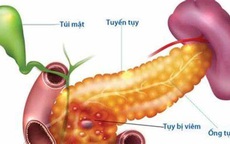 Điều bạn nhất định phải biết khi ăn để bảo vệ tuyến tụy